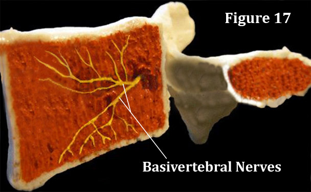 basivertebral nerve