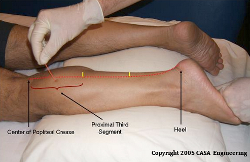 EMG test