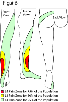 L4 dermatome